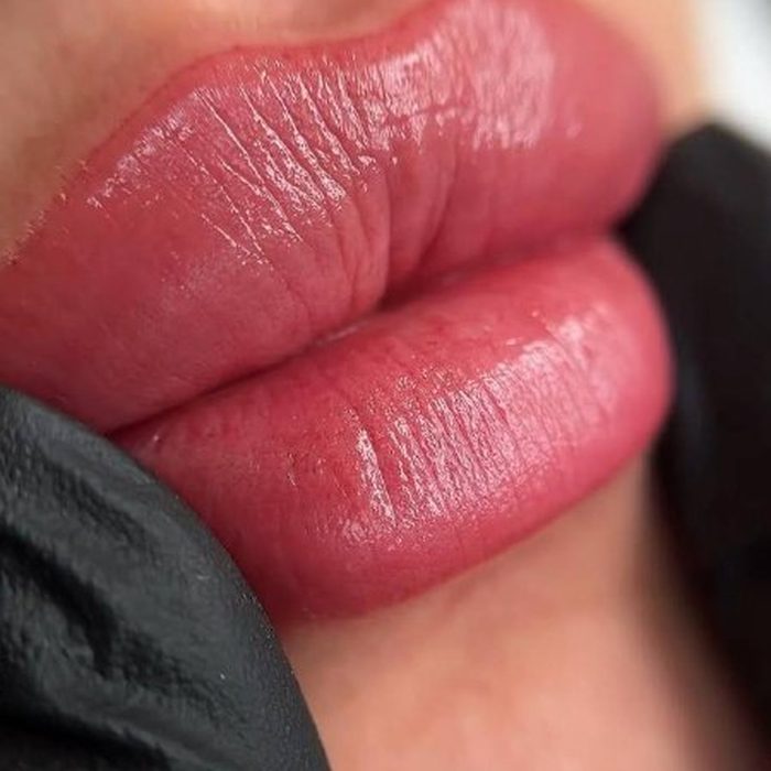 Lippen direkt nach der Behandlung, Farbe noch kräftig